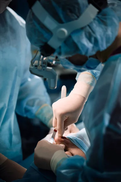 Un chirurgien avec des gants lui opère le nez. Rhinoplastie, opération de gros plan. Lumière bleue, travail d'équipe, santé, beauté — Photo