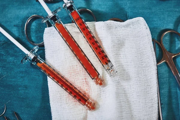 Жирные шприцы для пересадки жира на фоне синей стерильной ткани на мазке. Пластическая хирургия . — стоковое фото