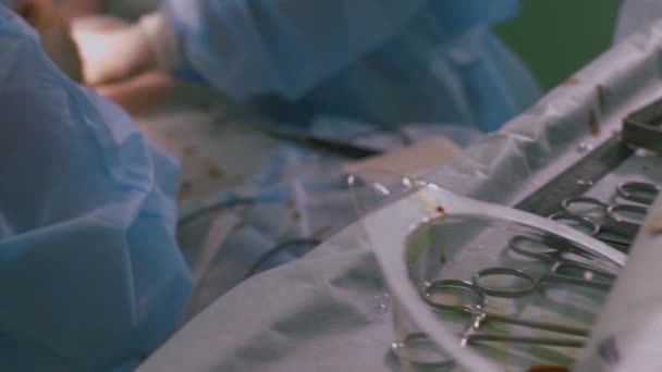 Surgical instruments and instruments in the operating room, during surgery, blood stains. Used tools after the operation. — Stock Video