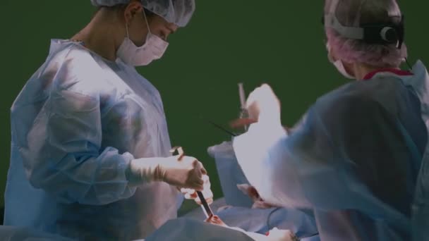 Крупный план хирурга. Врачи и ассистенты работают в операционной. Хирургическая бригада и медсестра во время настоящей операции в современной операционной, 4k — стоковое видео