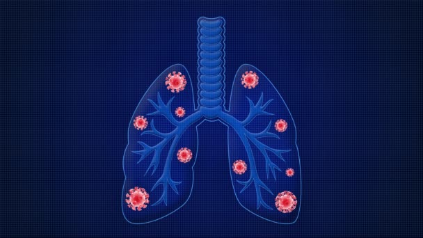 Animação médica de pulmões infectados pelo coronavírus SARS-CoV-2 causando difuculdade na respiração ou pneumonia ou outra doença pulmonar relacionada ao covídio-19. animação médica 3d. Animação solta. 3d — Vídeo de Stock
