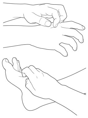 Bir kaşıntı, illüstrasyon vektör var