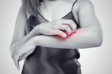 İnsanlar el ile kaşıntı çizik