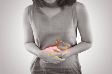 Gastroözofageal reflü hastalığı