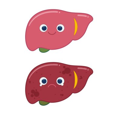 Comparison of healthy liver and fatty live clipart