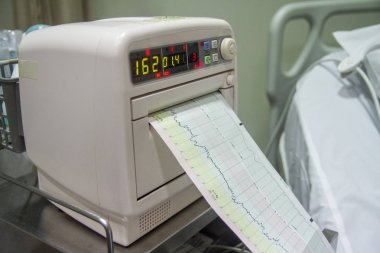 Kalp atış hızı monitörünü modern hastane hasta odasında