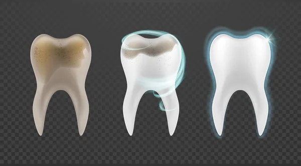 Zestaw Zębów Wybielanie Design Realistyczne Ilustracja Dentystycznych Kolekcja Zęby Szablon — Wektor stockowy
