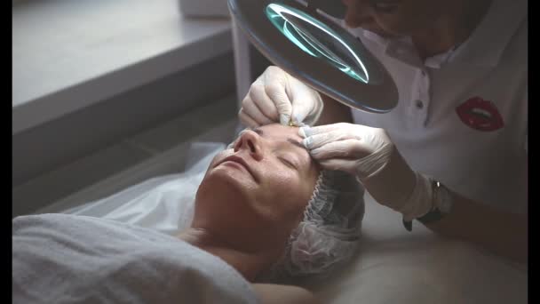 面部纤溶美容术注射治疗皮肤年轻化患者及医生 — 图库视频影像