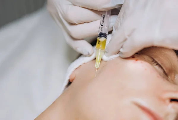 Kozmetik enjeksiyonları yüz yenileme plasmolift pa