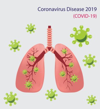 Coronavirus hastalığı COVID-19 insan ciğerlerinde tıbbi enfeksiyon. Virüs ya da bakteriyel enfeksiyon ciğerlere de bulaşır. Coronavirus akciğerlerde zatürreeye neden oluyor. Virüs zatürreeye neden oluyor. 2019-nCov Coronavirüs salgını.