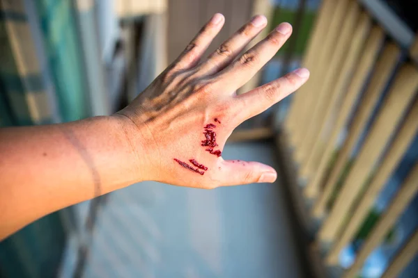 Bloody Hand Blood Background Large Wall — Foto Stock