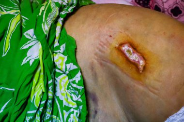 Yaralı bir kadının eline yaklaş.