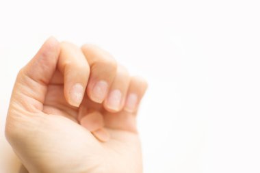 Beyaz arka plandaki kötü manikürden sonra kadın tırnaklarını kapat. Ove.