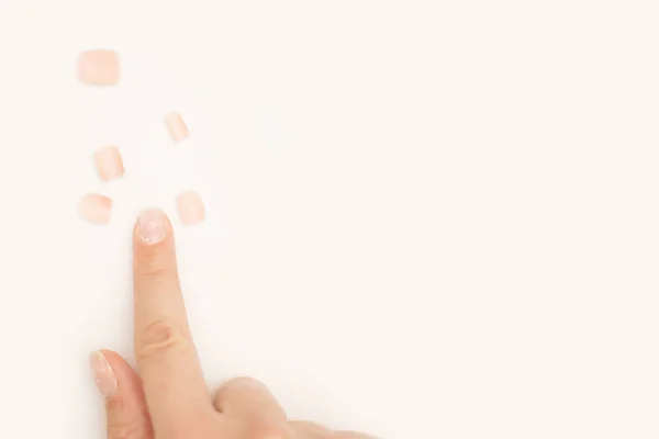 糟糕的指甲修整后的女装指甲表明，凝胶指甲油在浅背景下脱落。生长过度的角质层指甲和污迹斑斑的指甲板。复制空间。健康和护理概念 — 图库照片