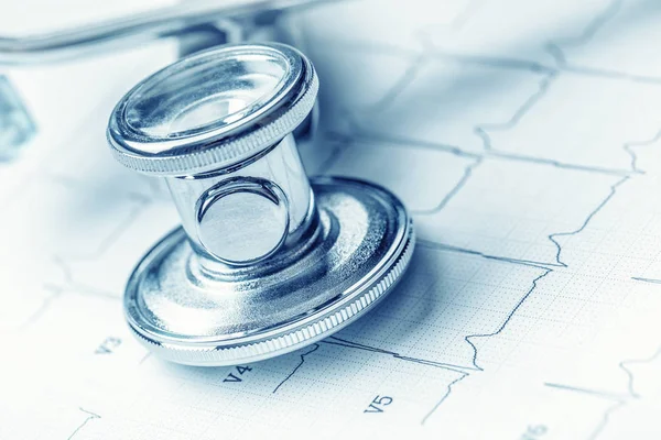 Stéthoscope sur une empreinte de moniteur cardiaque.Carte d'électrocardiogramme et stéthoscope — Photo