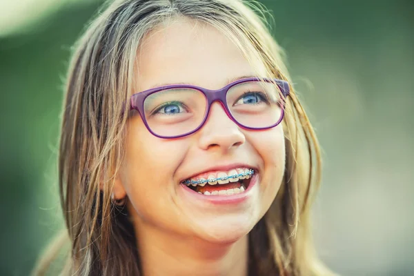歯科ブレースとメガネの幸せな笑顔の女の子。歯ブレースと眼鏡を身に着けている若いかわいい白人ブロンドの女の子 — ストック写真