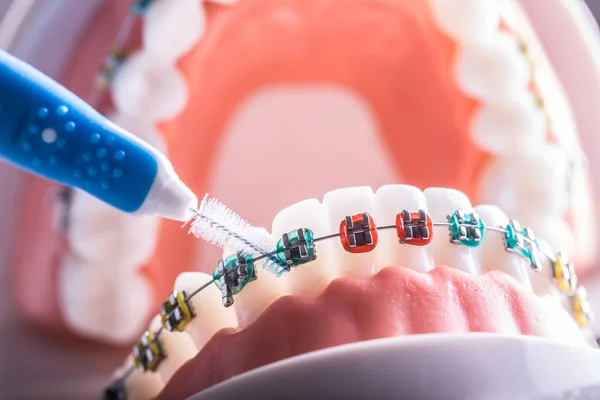 Model zęba z aparatu stomatologicznego ze szczoteczką do czyszczenia zębów — Zdjęcie stockowe