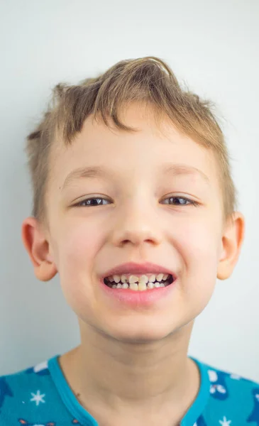 Porträtt av en pojke i pyjamas, dåliga tänder, närbild — Stockfoto