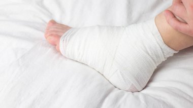 Kadın bacağına jöle sürüyor, bileği burkulmuş ve beyaz arka planda izole edilmiş. Ayak bileği burkulmuş, arka planda çürükler var. Atletizm antrenmanı kazası.