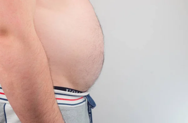 Homens Gordura Corporal Com Mão Segurando Gordura Excessiva Barriga Consequências — Fotografia de Stock