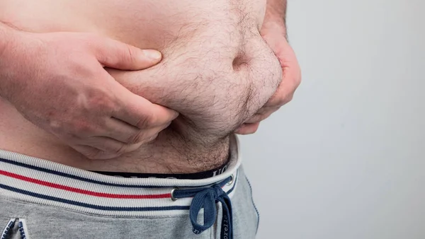 Close up of Man touching his fat belly, Men\'s hand holding excessive belly fat. Being overweight is one of the leading causes of major diseases such as heart disease, stroke, high blood pressure.
