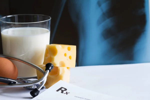 Osteoporoza produktu i rentgenowskie zdjęcie wapnia mleczne koncepcja — Zdjęcie stockowe