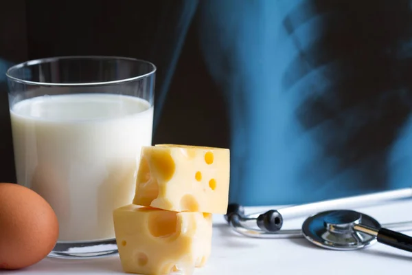 Osteoporosis calcium dairy product and x-ray photo concept — Stock Image Osteoporosis calcium dairy product and x-ray photo concept Stock Image