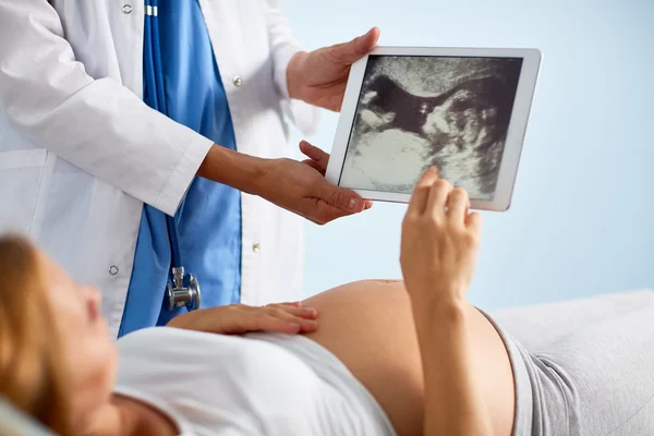 Médico mostrando ultra-som varredura do bebê — Fotografia de Stock