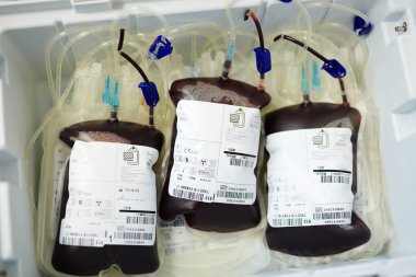 Kan ile plastik torbalar 