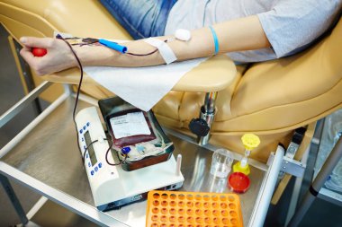 Hemotransfusion işlemi sırasında insan kolu