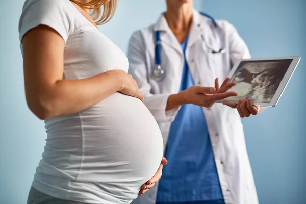 Médico explicando ultra-sonografia — Fotografia de Stock