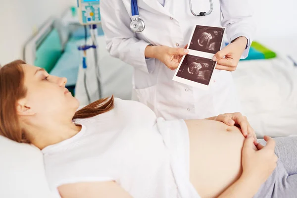 Žena při pohledu na ultrazvuk záběry — Stock fotografie