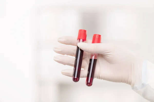 Ruka Rukavici Současné Kliničky Držící Dvě Baňky Vzorky Krve Během — Stock fotografie
