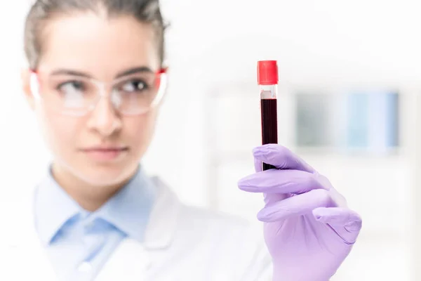 Gloved Hand Young Female Clinician Chemist Holding Flask Sample New — Stock Photo, Image