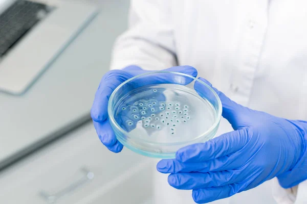 Gloved Hands Scientific Researcher Holding Petri Dish Large Group Bacteria — Stock Photo, Image