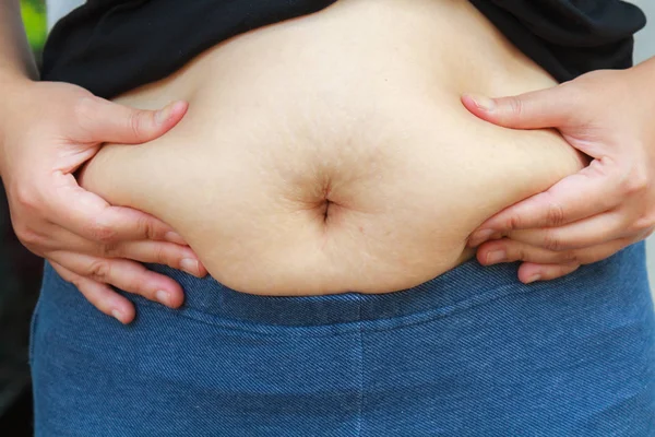 Kız göbekli şişman