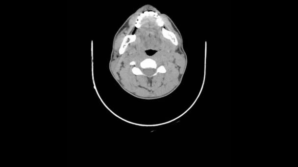 Tomografía Computarizada Del Cuerpo Examen Cabeza Cuello Pecho — Vídeos de Stock