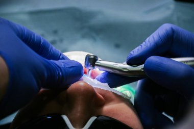 Dişçi dişçide bir kadın hastayı tedavi ediyor. Tedavi kavramı