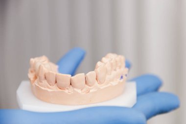 Çenenin kalıpları. Dişçide eğitim. Anatomik diş izleri. Ortodontist için eğitim