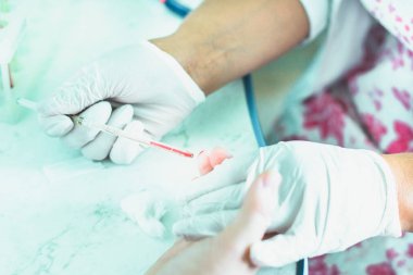 Genel kan testi için laboratuvar teknisyeninden alınan hasta kanı örneği..