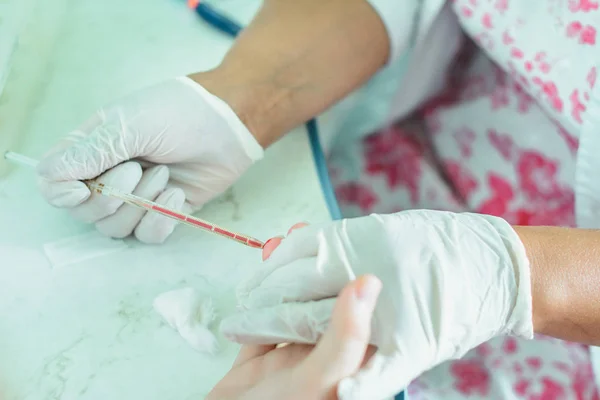 Muestreo de sangre del paciente por un técnico de laboratorio para análisis generales de sangre . — Foto de Stock