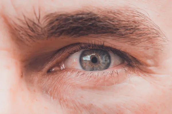 Närbild av manliga ögon, konjunktivit och fräknar. — Stockfoto
