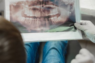 Bir ortodontist doktor çocuğa dişlerinin röntgenini gösteriyor..