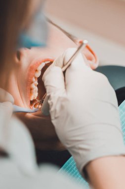 Çocuk bir ortodontist tarafından muayene edildi, ağzını iyice açtı ve dişçi dişlerini muayene etti..