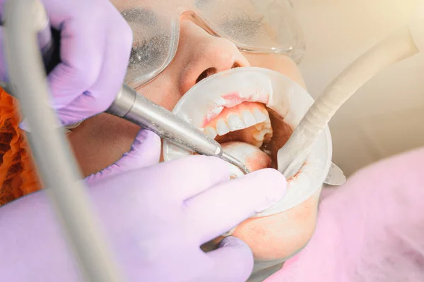 Fogorvos ultrahang eltávolítja kövek a fogak egy nő egy fogászati pad a száját. — Stock Fotó