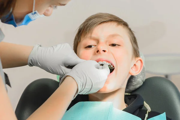 A fiú nyitott szájjal fekszik a fogorvos székében, míg a fogorvos a fogán tartja a tányért.. — Stock Fotó