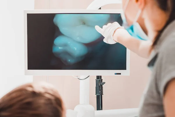Una dentista joven examina los dientes de un niño sentado en una silla dental con una cámara dental . — Foto de Stock