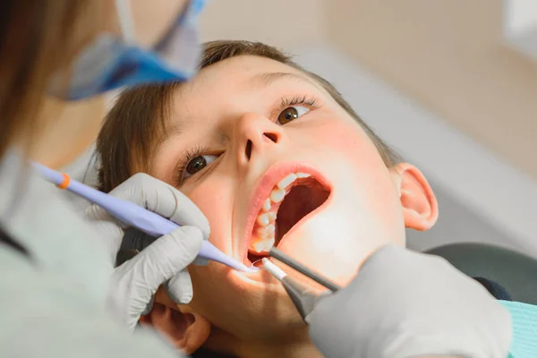 Chłopiec zbadany przez ortodontę, otworzył szeroko usta i dentysta zbadał jego zęby.. — Zdjęcie stockowe