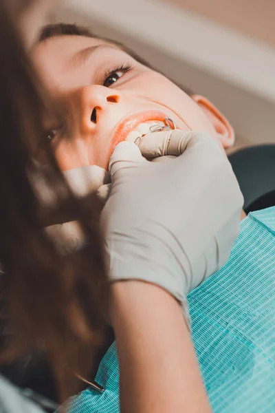 A fiú nyitott szájjal fekszik a fogorvos székében, míg a fogorvos a fogán tartja a tányért.. — Stock Fotó