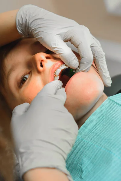 Der Junge liegt mit offenem Mund im Zahnarztstuhl, während der Kieferorthopäde die Platte auf den Zähnen hält. — Stockfoto